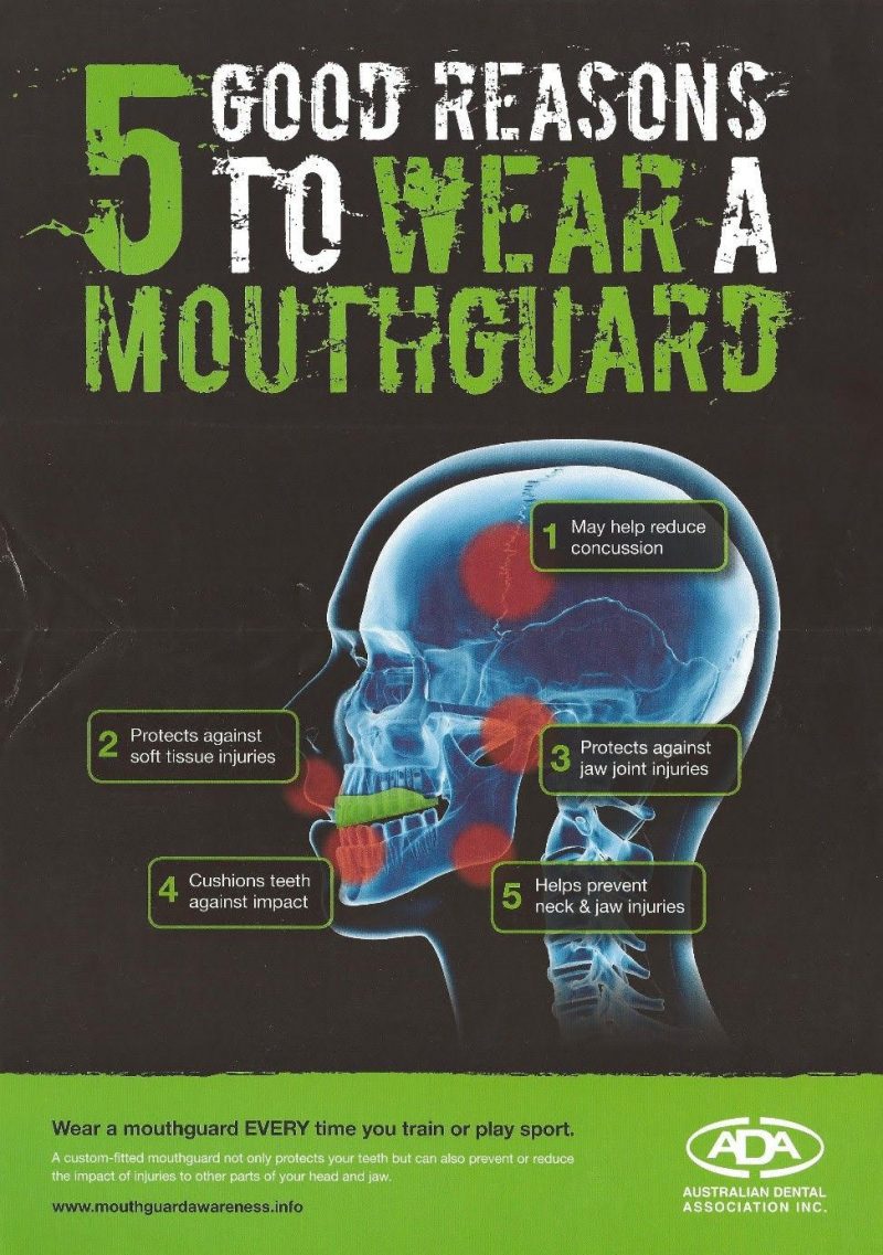 Play it safe, Wear a mouthguard Alexandra Dental Clinic